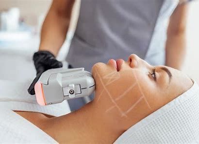 HIFU - High Intensity Focused Ultrasound